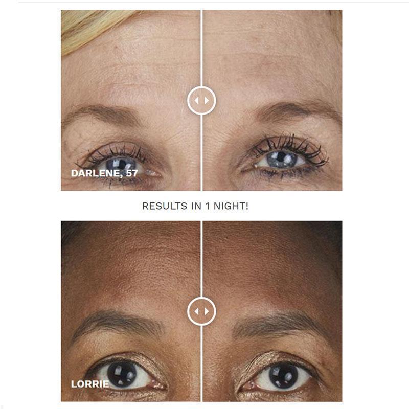 SIO Beauty- BrowLift Skincare - Special SIO Beauty 